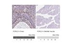 Immunohistochemistry analysis in human ovary and skeletal muscle tissues using HPA069613 antibody. Corresponding FOXL2 RNA-seq data are presented for the same tissues.