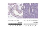 Immunohistochemistry analysis in human testis and endometrium tissues using Anti-RP11-195F19.5 antibody. Corresponding RP11-195F19.5 RNA-seq data are presented for the same tissues.