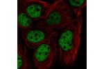Immunofluorescent staining of human cell line HaCaT shows localization to nucleoplasm.