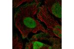 Immunofluorescent staining of human cell line U-2 OS shows localization to nucleus, plasma membrane & vesicles.