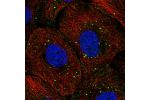 Immunofluorescent staining of human cell line HaCaT shows localization to vesicles.