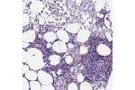 Immunohistochemical staining of human bone marrow shows cytoplasmic positivity in hematopoietic cells.