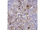 Immunohistochemical staining of human pituitary gland shows moderate to strong cytoplasmic positivity in glandular cells in anterior lobe.