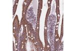 Immunohistochemical staining of human small intestine shows strong granular positivity in glandular cells.