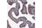 Immunohistochemical staining of human fallopian tube shows moderate nuclear positivity in glandular cells.