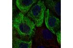 Immunofluorescent staining of human cell line A-431 shows localization to intermediate filaments.