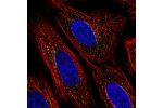 Immunofluorescent staining of human cell line SiHa shows localization to vesicles.