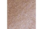 Immunohistochemical staining of human cerebral cortex shows cytoplasmic positivity in axonal projections.