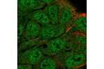 Immunofluorescent staining of human cell line RT4 shows localization to nucleoplasm & cytosol.