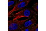Immunofluorescent staining of human cell line U-251 MG shows localization to plasma membrane.