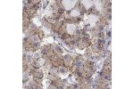 Immunohistochemical staining of human pituitary gland shows strong cytoplasmic positivity in anterior cells.