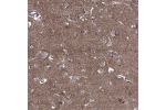 Immunohistochemical staining of human cerebral cortex shows cytoplasmic positivity in neuronal cells and neuropil.