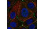 Immunofluorescent staining of human cell line MCF7 shows localization to plasma membrane & cell junctions.