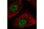 Immunofluorescent staining of human cell line A549 shows localization to nucleoplasm.