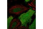 Immunofluorescent staining of human cell line SiHa shows localization to nucleoplasm, plasma membrane & cytosol.