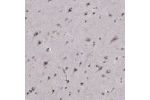 Immunohistochemical staining of human cerebral cortex shows moderate cytoplasmic and nuclear positivity in neuronal cells.