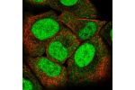 Immunofluorescent staining of human cell line HaCaT shows localization to nucleoplasm & cytoplasmic bodies.