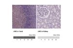 Immunohistochemistry analysis in human appendix and liver tissues using Anti-JAK3 antibody. Corresponding JAK3 RNA-seq data are presented for the same tissues.
