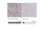 Immunohistochemistry analysis in human smooth muscle and liver tissues using Anti-YAP1 antibody. Corresponding YAP1 RNA-seq data are presented for the same tissues.