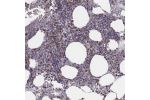 Immunohistochemical staining of human bone marrow shows nuclear positivity in hematopoietic cells.