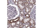 Immunohistochemical staining of human kidney shows strong cytoplasmic positivity with a granular pattern in cells in tubules.