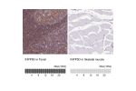 Immunohistochemical staining of human small intestine shows strong cytoplasmic positivity in lymphoid cells.