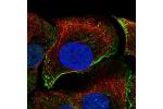 Immunofluorescent staining of human cell line HaCaT shows localization to nucleoplasm, plasma membrane & vesicles.