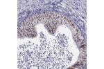 Immunohistochemical staining of human epididymis shows moderate nuclear positivity in glandular cells.