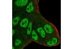 Immunofluorescent staining of human cell line RT4 shows localization to nucleoplasm & cytosol.