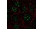 Immunofluorescent staining of human cell line MCF7 shows localization to nucleus & nucleoli.