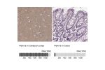 Immunohistochemistry analysis in human cerebral cortex and colon tissues using Anti-PEA15 antibody. Corresponding PEA15 RNA-seq data are presented for the same tissues.