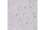 Immunohistochemical staining of human cerebral cortex shows strong cytoplasmic positivity in glial cells.