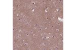 Immunohistochemical staining of human cerebral cortex shows moderate nucleolar positivity in neuronal cells, neuropil was moderately stained.