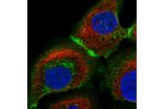 Immunofluorescent staining of human cell line HaCaT shows localization to plasma membrane, cell junctions & vesicles.