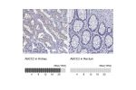 Immunohistochemistry analysis in human kidney and rectum tissues using Anti-ABCC2 antibody. Corresponding ABCC2 RNA-seq data are presented for the same tissues.