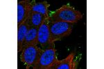 Immunofluorescent staining of human cell line SH-SY5Y shows localization to plasma membrane.
