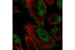Immunofluorescent staining of human cell line U-251 MG shows localization to nucleoplasm & plasma membrane.