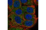 Immunofluorescent staining of human cell line MCF7 shows localization to cytosol.