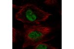 Immunofluorescent staining of human cell line U-251 MG shows localization to nucleoplasm.