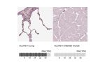 Immunohistochemistry analysis in human spleen and skeletal muscle tissues using HPA071285 antibody. Corresponding ALOX5 RNA-seq data are presented for the same tissues.