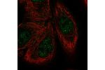 Immunofluorescent staining of human cell line HaCaT shows localization to nucleoplasm.