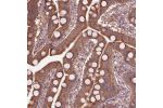 Immunohistochemical staining of human duodenum shows strong cytoplasmic positivity in glandular cells.