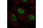 Immunofluorescent staining of human cell line A549 shows localization to nucleoplasm.