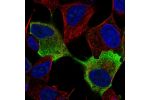 Immunofluorescent staining of human cell line SH-SY5Y shows localization to plasma membrane.