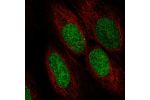 Immunofluorescent staining of human cell line U-2 OS shows localization to nucleoplasm.