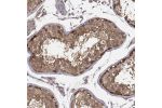 Immunohistochemical staining of human testis shows strong cytoplasmic positivity in cells in seminiferous ducts.