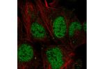 Immunofluorescent staining of human cell line HEK 293 shows localization to nucleoplasm & cytoplasmic bodies.