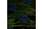 Immunofluorescent staining of human cell line ASC TERT1 shows localization to plasma membrane.