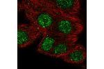 Immunofluorescent staining of human cell line MCF7 shows localization to nucleoplasm & nuclear bodies.