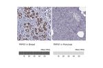 Immunohistochemistry analysis in human breast and pancreas tissues using HPA071767 antibody. Corresponding TRPS1 RNA-seq data are presented for the same tissues.